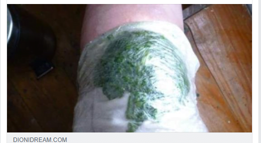 Come preparare gli impacchi di cavolo