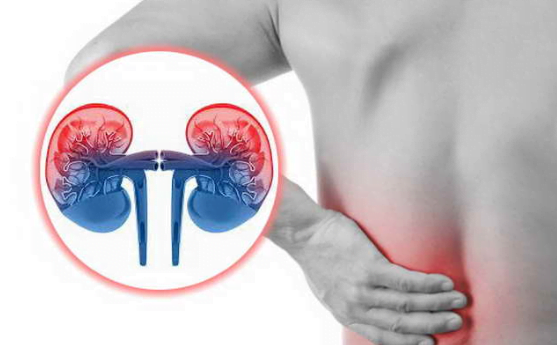 Cose che fai tutti i giorni e che danneggiano i reni