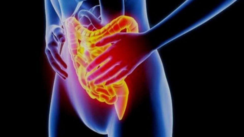 infiammazione intestinale