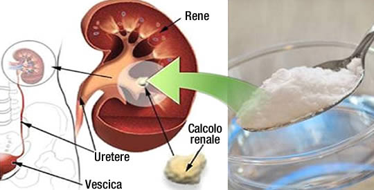 come riparare i reni col bicarbonato
