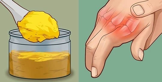 curcuma e latte contro il dolore alle giunture