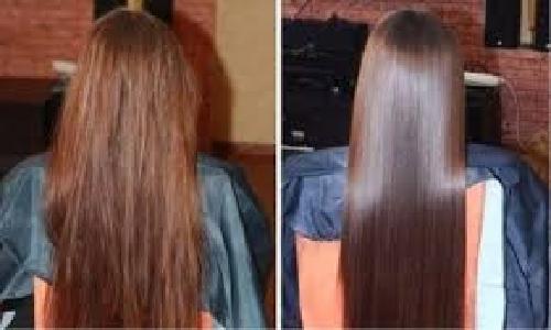 aceto di mele per la forfora