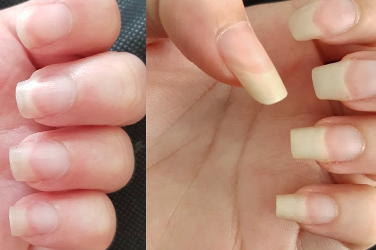 bicarbonato di sodio ecco come unghie sane