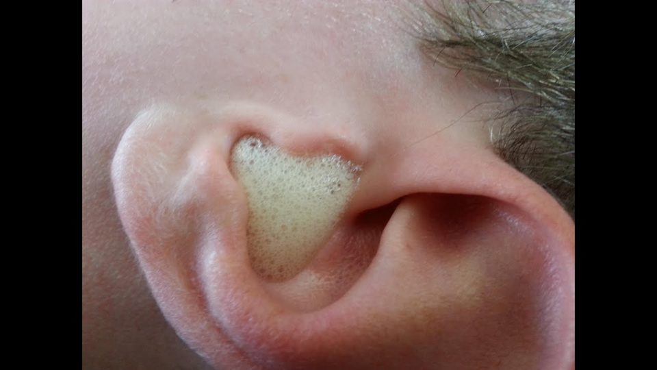 stappare le orecchie con acqua ossigenata