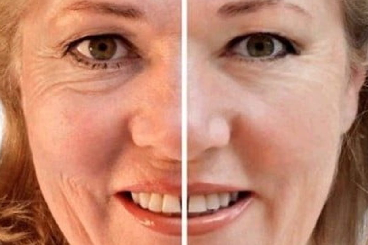 rughe addio come sconfiggerle con 4