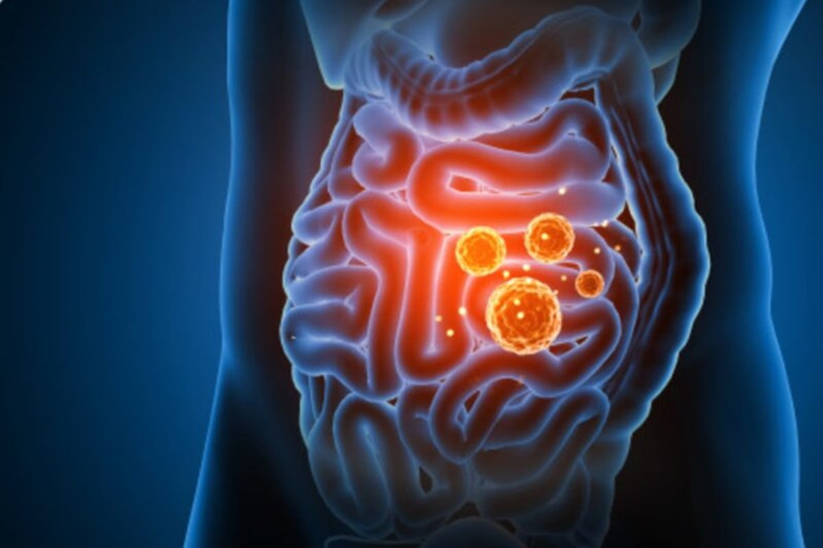 esiste una salsa in cucina intestino