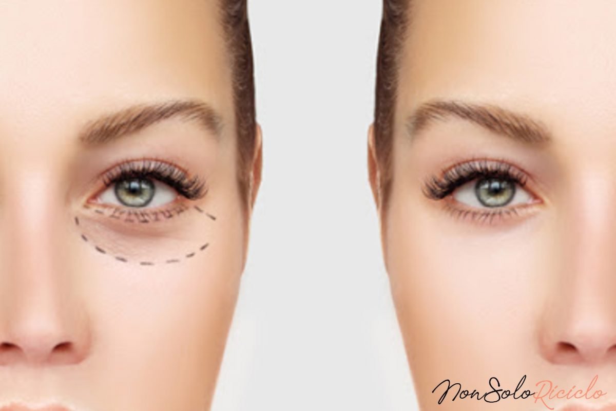 occhiaie scavate se il correttore 6