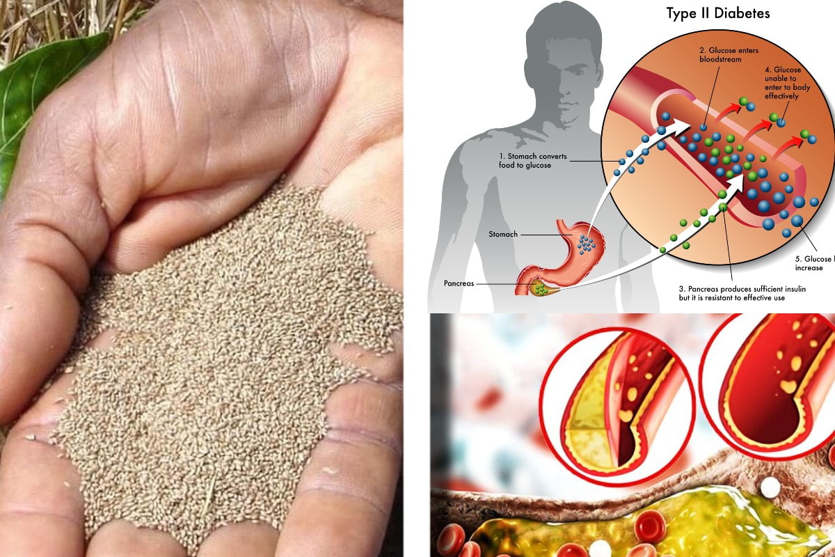 abbassa il diabete e ricco FONIO 1
