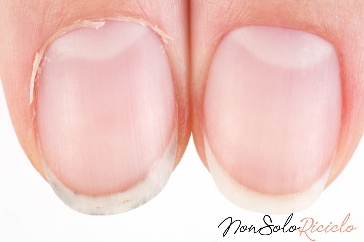 cuticole addio basta solo questo 4