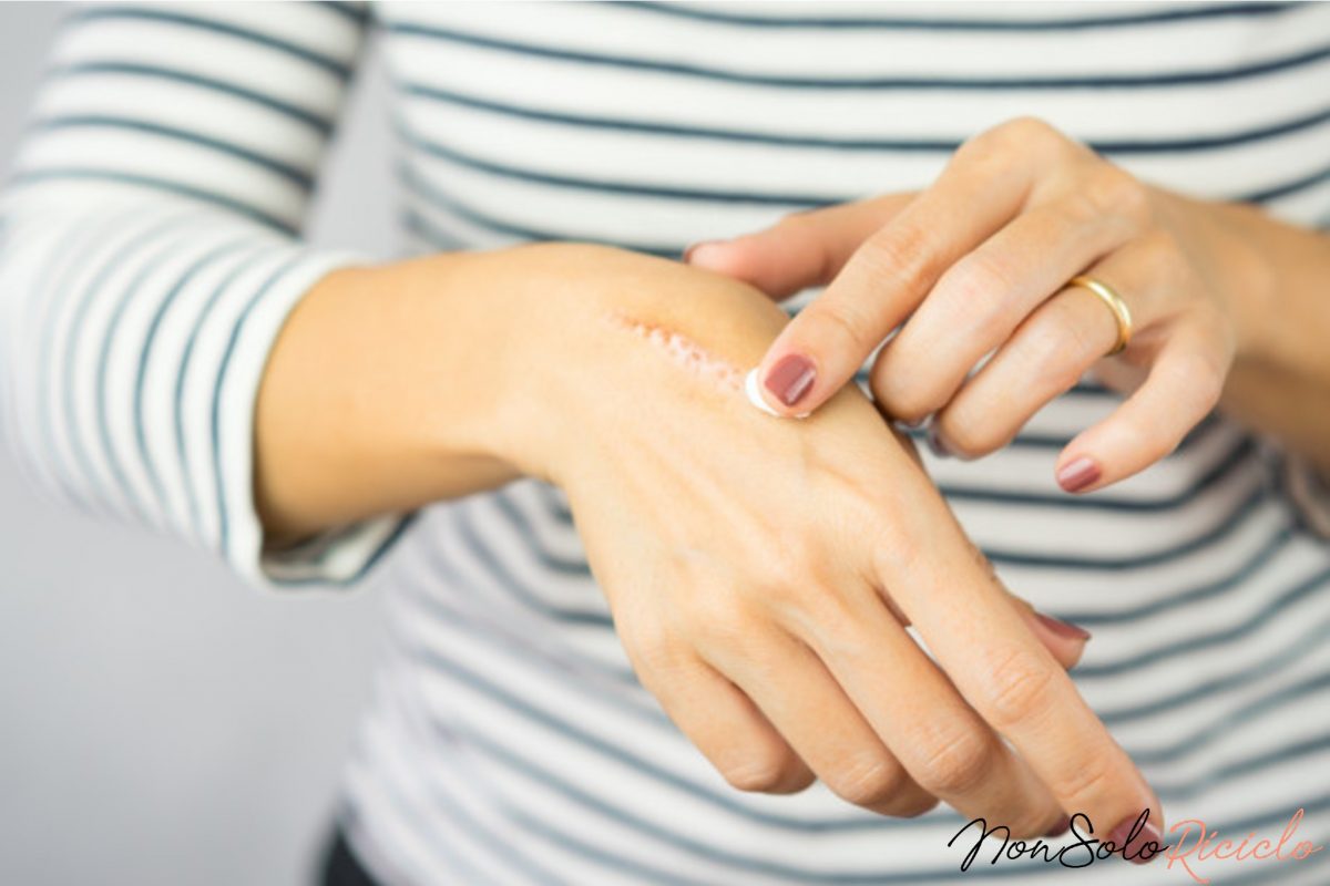 il cicatrizzante naturale piu efficace 3