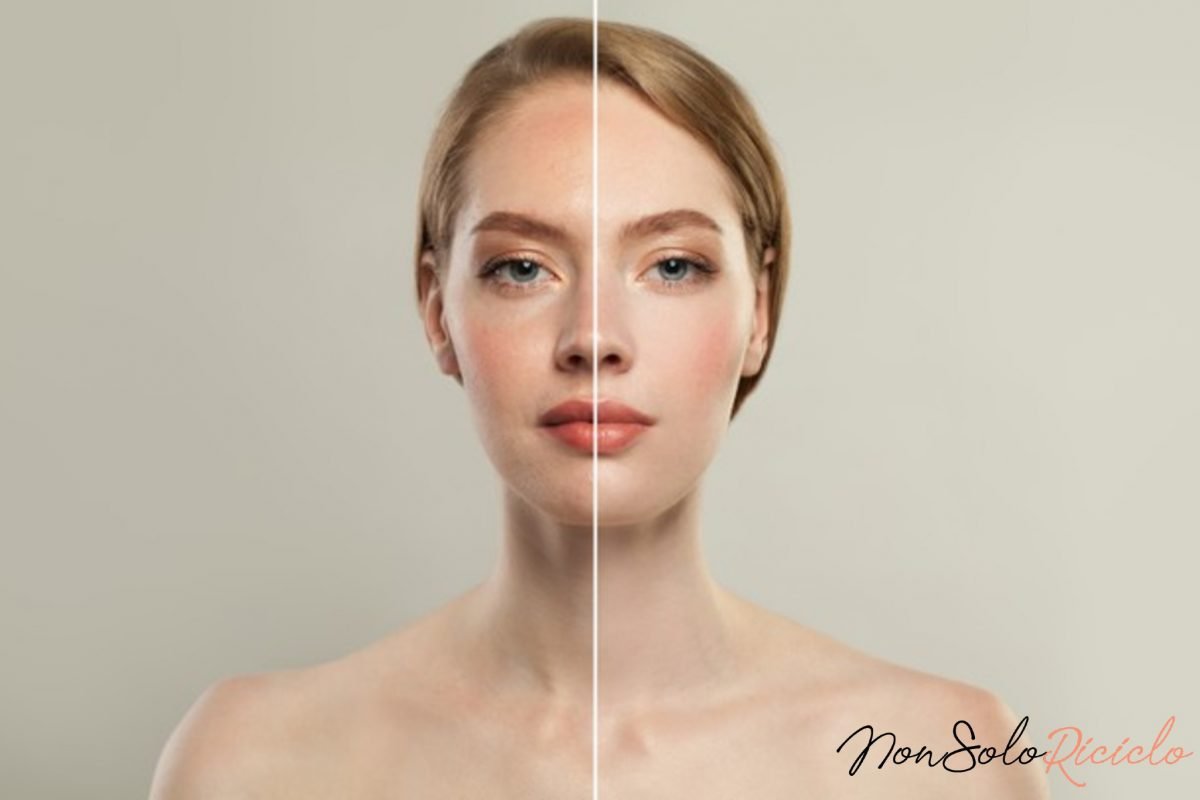 niacinamide tutti i benefici dellingrediente 5