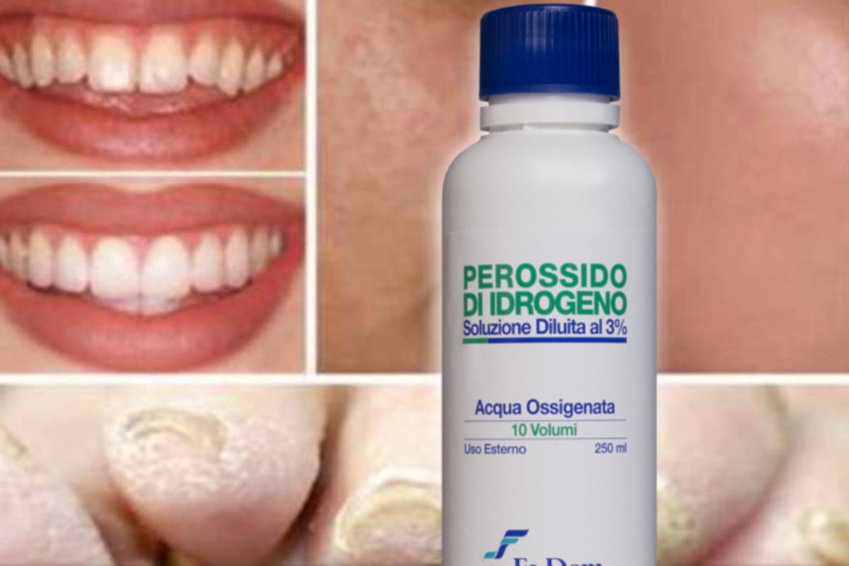 acqua ossigenata scopri alcuni usi acqua ossigenata 3