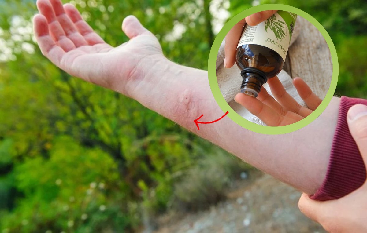 tea tree oil 421 modi tea tree oil usi e benefici