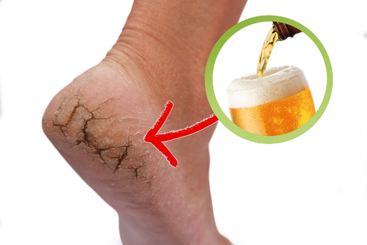 10 usi alternativi della birra usi della birra