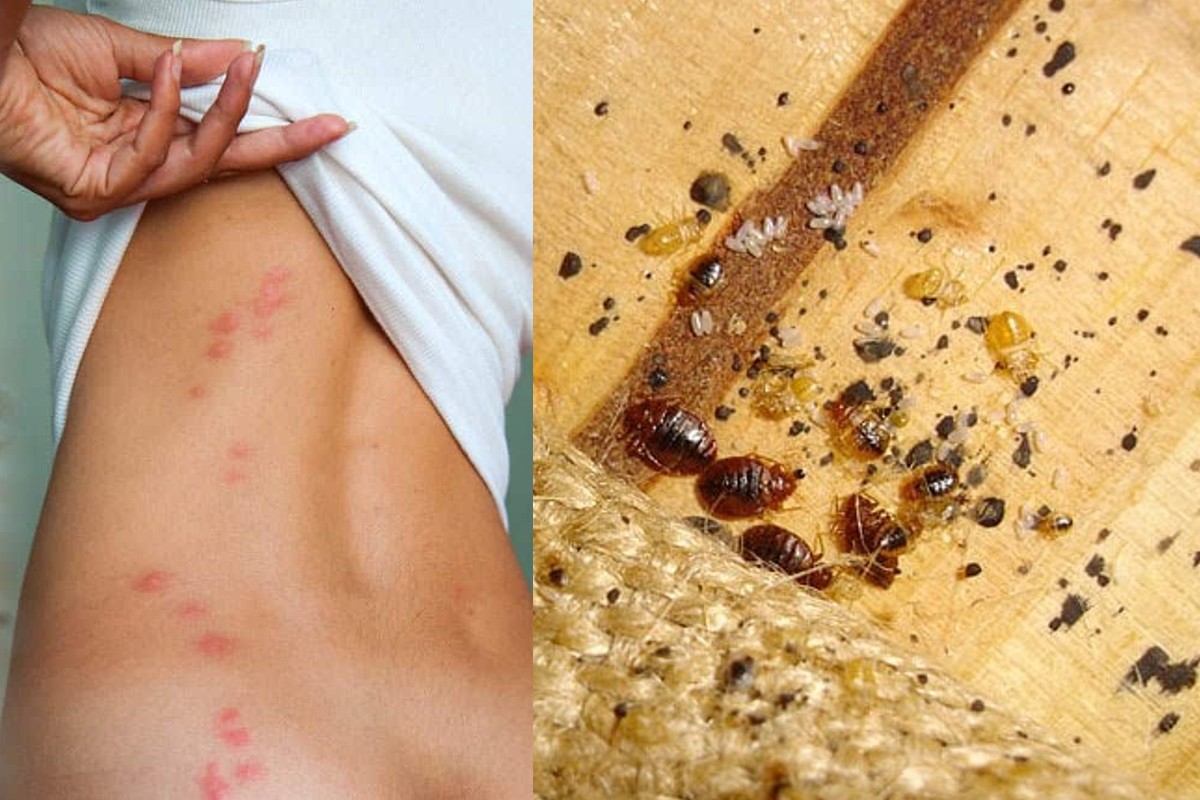 cimici dei letti dove si cimici da letto