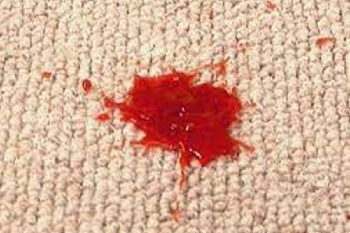 macchie di cera sui vestiti 013