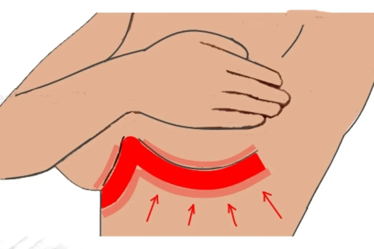 sudore ed eruzioni cutanee sotto seno eruzioni 1536x1024.jpg